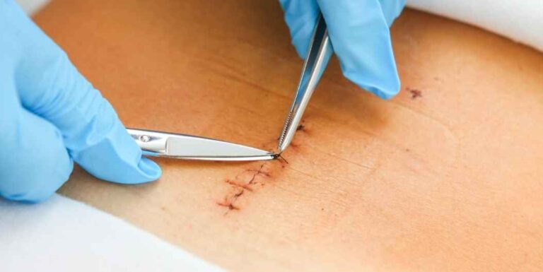 Dikiş Alma Ayvalık